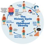 Awas obesitas pada anak bisa menyebabkan diabetes