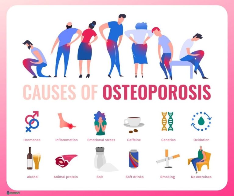 Risk osteoporosis factors facts bone health risks prevent fracture dexa know factor infographic lancaster ways learn prevention choose board