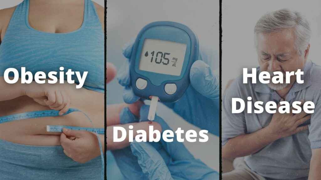 Awas obesitas pada anak bisa menyebabkan diabetes