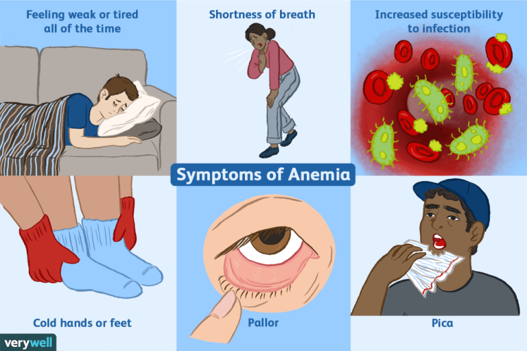 Anemia deficiency hemoglobin shortness breath brianna gilmartin verywell headed darah