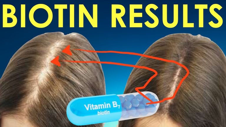 Bisakah biotin vitamin membantu rambut pria tumbuh