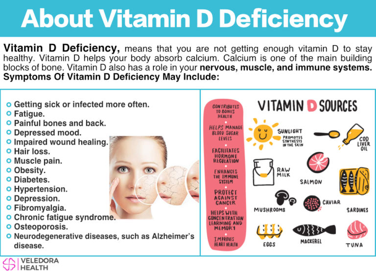 Ciri ciri dan akibat kekurangan vitamin d serta cara memenuhi asupannya