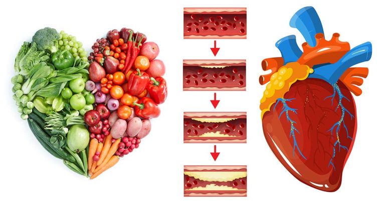 Cara mencegah penyakit jantung dengan pemenuhan nutrisi ini