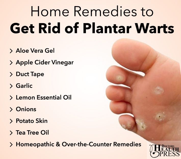 Warts rid remedies remedy naturally mylowcarbrecipe growths healthnutritionhome