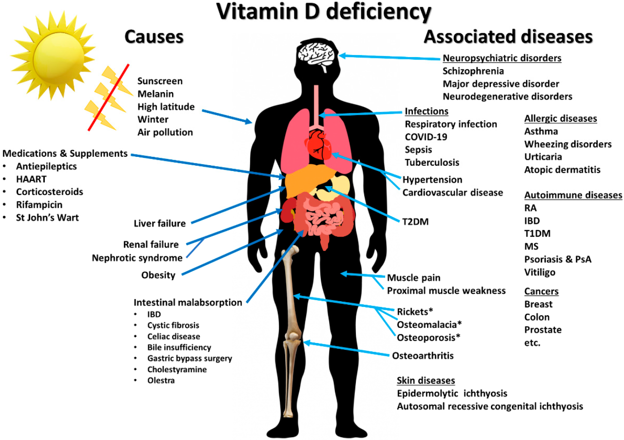 Ciri ciri dan akibat kekurangan vitamin d serta cara memenuhi asupannya