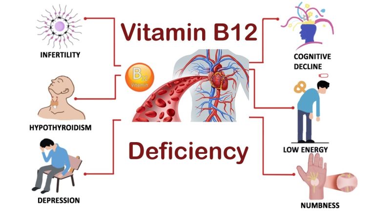 Kenali gejala kekurangan vitamin b complex dan dampaknya bagi tubuh