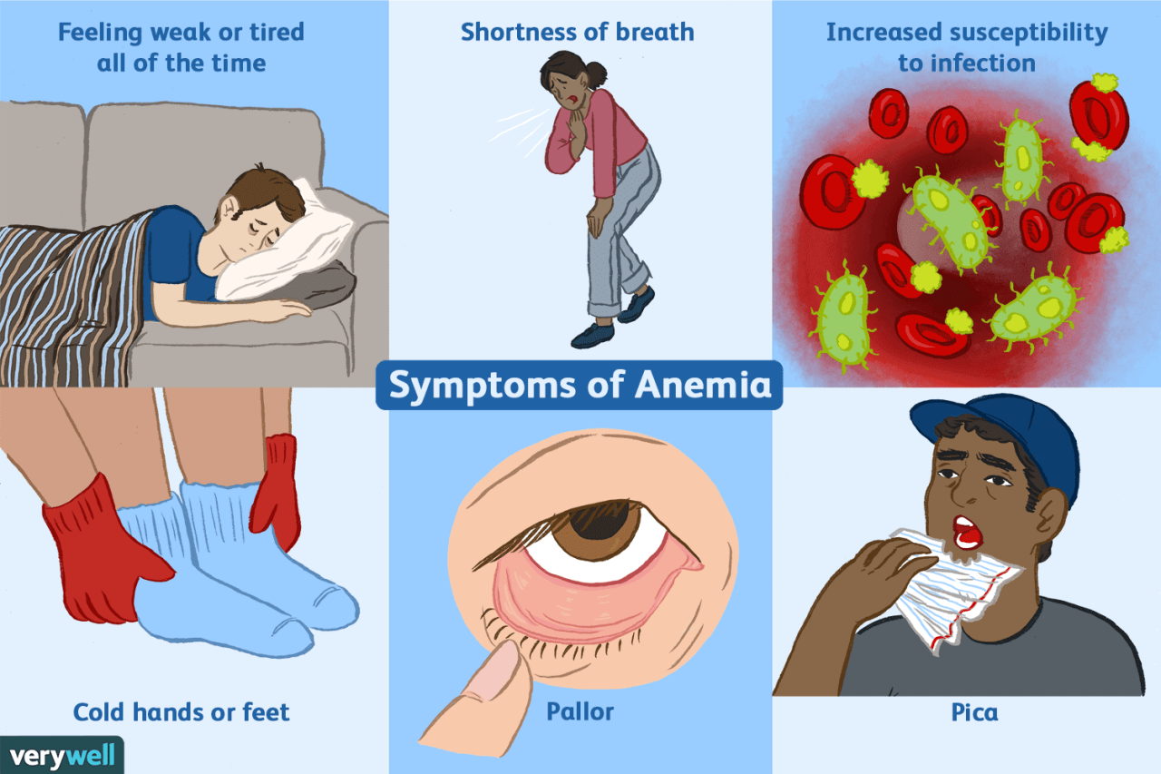 Ketahui gejala penyebab dan tips mencegah anemia