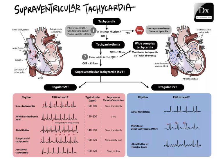 Tachycardia manage recreational avoid drugs medicines draxe