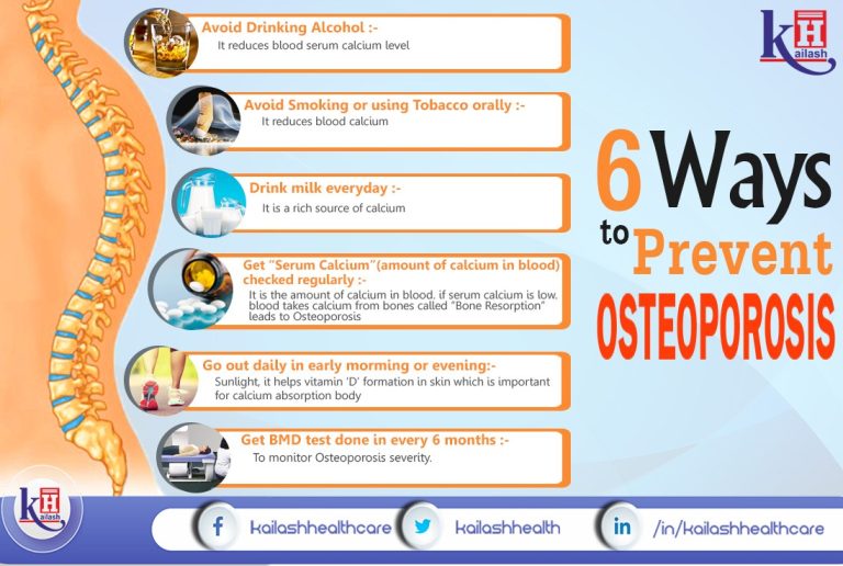 Penuhi vitamin ini untuk mencegah osteoporosis