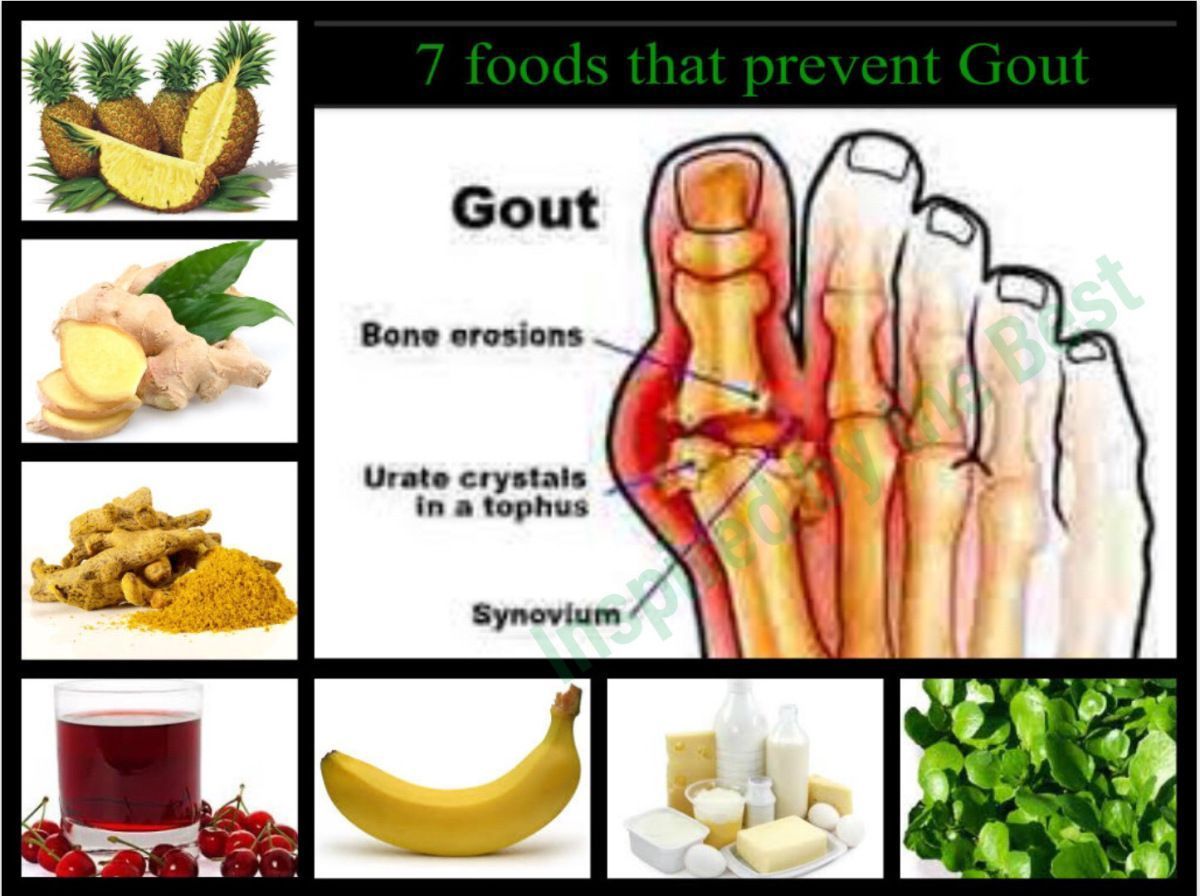 Gout remedies natural pain cure arthritis stylenrich hands cures choose board