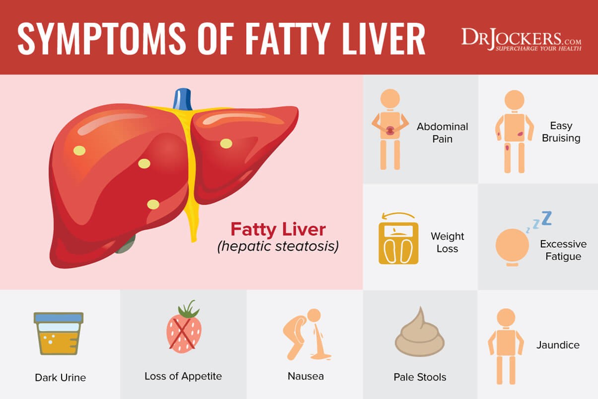 Pahami fatty liver pengertian gejala dan cara mencegahnya