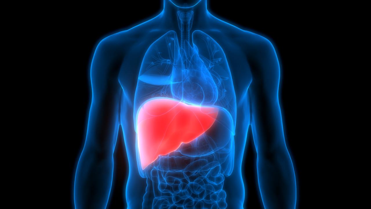 Pahami fatty liver pengertian gejala dan cara mencegahnya