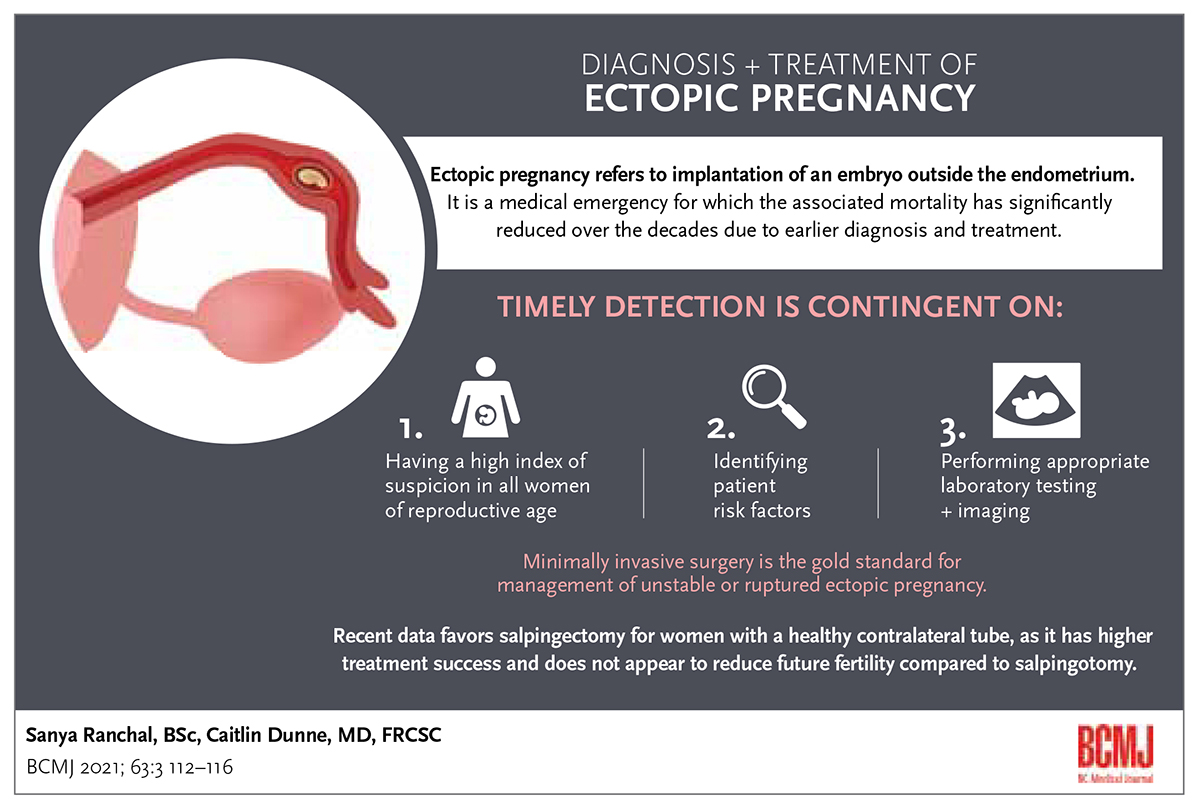 Ectopic infographics